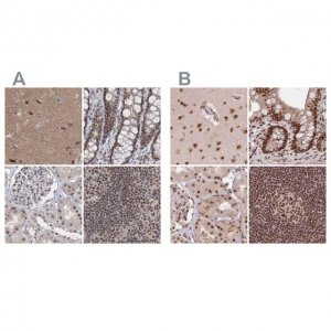 Anti-PDS5A antibody produced in rabbit 