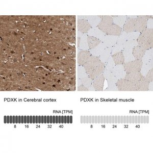 Anti-PDXK antibody produced in rabbit 