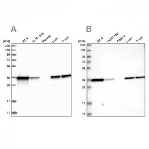 Anti-PDXK antibody produced in rabbit 