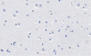 Anti-PEA15 Antibody, clone 2J13 ZooMAb Rabbit Monoclonal 