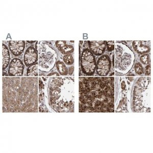 Anti-PECR antibody produced in rabbit HPA022539-100UL