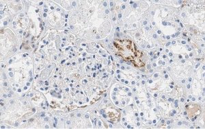 Anti-PEDF (SERPIN F1) Antibody, clone 2C16 ZooMAb Rabbit Monoclonal 