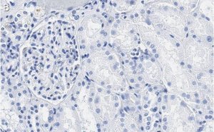 Anti-PEDF (SERPIN F1) Antibody, clone 2C16 ZooMAb Rabbit Monoclonal 