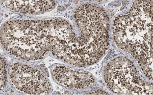Anti-PER2 Antibody, clone 1G17 ZooMAb Rabbit Monoclonal 