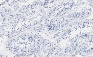 Anti-PER2 Antibody, clone 1G17 ZooMAb Rabbit Monoclonal 