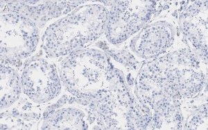 Anti-Pericentrin Antibody, clone 2H11, ZooMAb Rabbit Monoclonal 