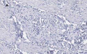 Anti-Peripherin Antibody, clone 1D4, ZooMAb Rabbit Monoclonal 