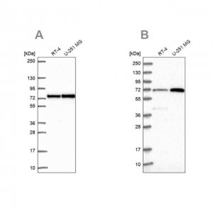 Anti-PES1 antibody produced in rabbit 