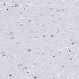 Anti-PES1 antibody produced in rabbit 