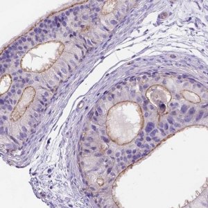 Anti-PEX12 antibody produced in rabbit 