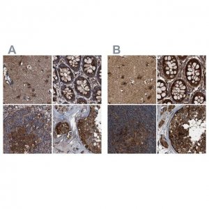 Anti-PEX5 antibody produced in rabbit 