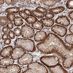 Anti-PFDN2 antibody produced in rabbit 