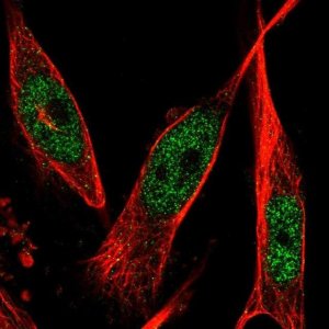 Anti-PFKFB3 antibody produced in rabbit 