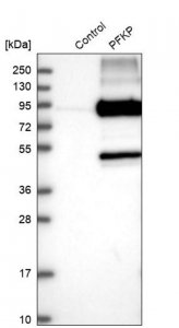 Anti-PFKP antibody produced in rabbit 