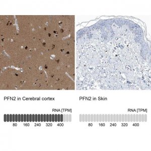 Anti-PFN2 antibody produced in rabbit 