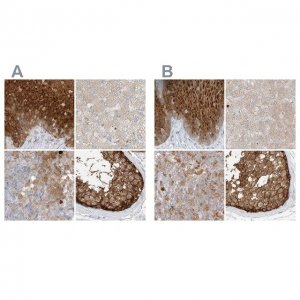 Anti-PGD antibody produced in rabbit HPA031315-100UL