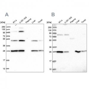 Anti-PGLS antibody produced in rabbit 