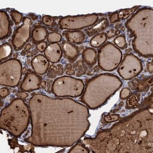 Anti-PGLS antibody produced in rabbit 