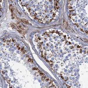 Anti-PGM2 antibody produced in rabbit 
