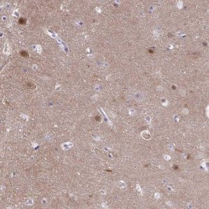 Anti-PGM2L1 antibody produced in rabbit HPA056995-100UL