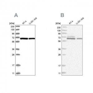 Anti-PGM3 antibody produced in rabbit 