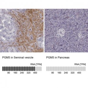 Anti-PGM5 