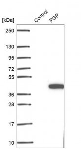 Anti-PGP antibody produced in rabbit 