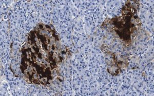 Anti-PGP9.5/UCHL1 Antibody, clone 3C13 ZooMAb Rabbit Monoclonal 