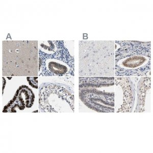Anti-PGR antibody produced in rabbit 