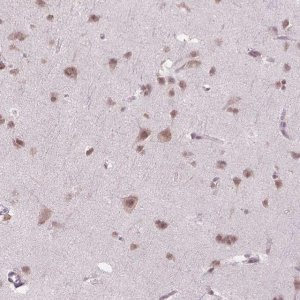 Anti-PHAX antibody produced in rabbit 
