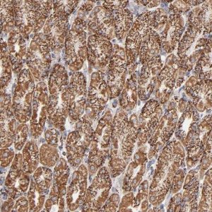Anti-PHB antibody produced in rabbit 