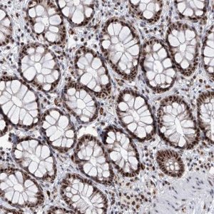 Anti-PHF5A antibody produced in rabbit 