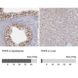 Anti-PHF6 antibody produced in rabbit 