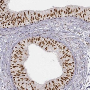 Anti-PHF6 antibody produced in rabbit 