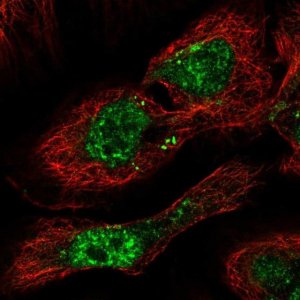 Anti-PHF7 antibody produced in rabbit 