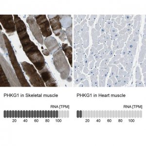Anti-PHKG1 antibody produced in rabbit 