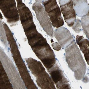 Anti-PHKG1 antibody produced in rabbit 