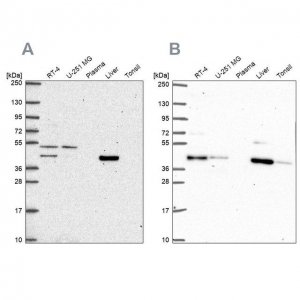 Anti-PHKG2 antibody produced in rabbit 
