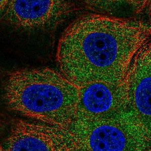 Anti-PHKG2 antibody produced in rabbit 