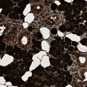 Anti-PHLDA1 antibody produced in rabbit 