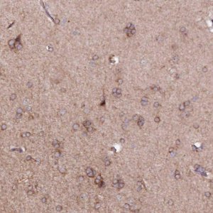 Anti-PHLDB1 antibody produced in rabbit 