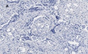 Anti-phospho JNK (Thr183, Tyr185) Antibody, clone 3F7, ZooMAb Rabbit Monoclonal 