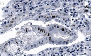 Anti-phospho-Chk2-Thr68 Antibody, clone 1B17 ZooMAb Rabbit Monoclonal 