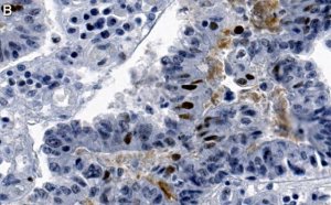 Anti-phospho-Chk2-Thr68 Antibody, clone 1B17 ZooMAb Rabbit Monoclonal 