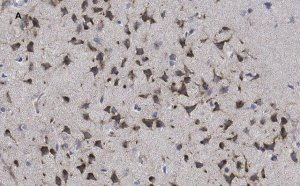 Anti-phospho-GluR1 (Ser831) Antibody, clone N453, ZooMAb Rabbit Monoclonal 