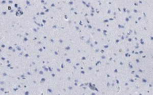 Anti-phospho-GluR1 (Ser831) Antibody, clone N453, ZooMAb Rabbit Monoclonal 