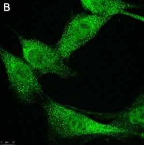 Anti-phospho-IRE-1 (Ser724) Antibody, clone 1M2 ZooMAb Rabbit Monoclonal 