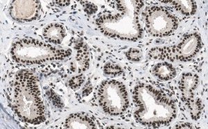 Anti-phospho-p53 (Ser15) Antibody, clone 5L22 ZooMAb Rabbit Monoclonal 