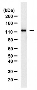 Anti-phospho-ULK1-Ser757 Antibody, clone 5L18 ZooMAb Rabbit Monoclonal 