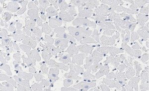 Anti-Phospholamban Antibody, clone 4J16 , ZooMAb Rabbit Monoclonal 